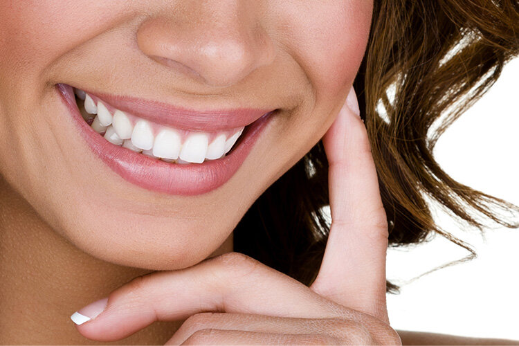 lindsay giguiere, smiles for miles, teeth whitening kit